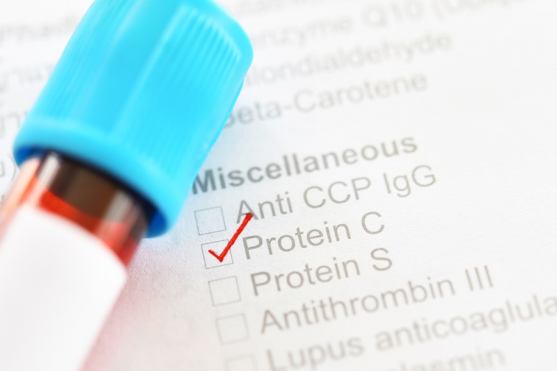 Xét nghiệm protein C là một xét nghiệm đông máu chuyên sâu